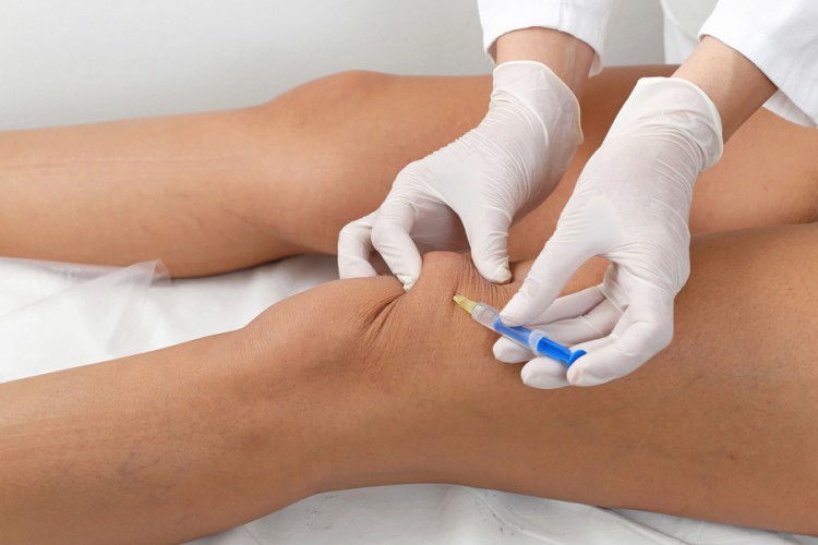 injections-knee-joint-inflammation-stem-cells-cortisone-platelets-lubricants-painless-relief.jpg