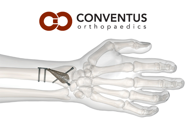 conventus-ortho-large-3x2.jpg