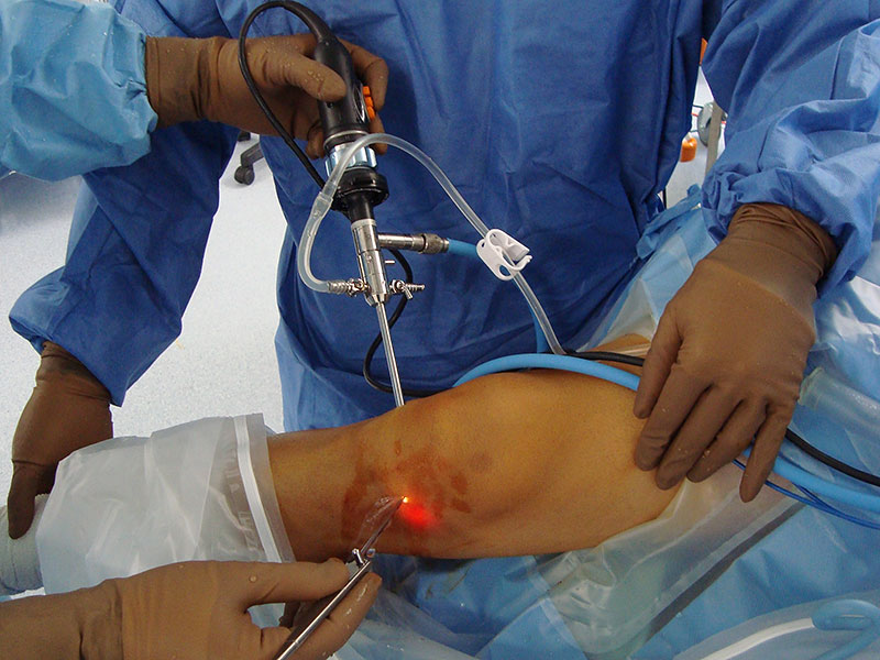knee-arthroscopy-2.jpg