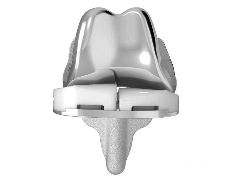 ConforMIS Announces Study Comparing Customized Total Knee Replacement Implants to OfftheShelf