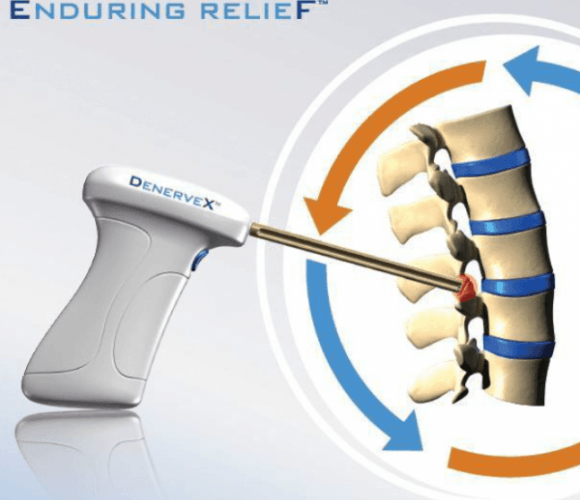 Medovex-Chronic-back-pain-relief-e1500503666721.png