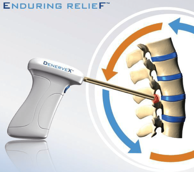 Medovex-Chronic-back-pain-relief-1.png
