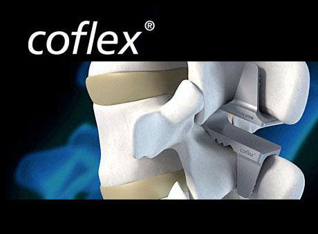 coflex-product-image1.jpg