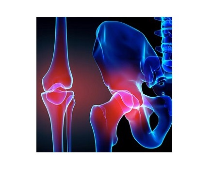 joint-replacement-123-1.jpg