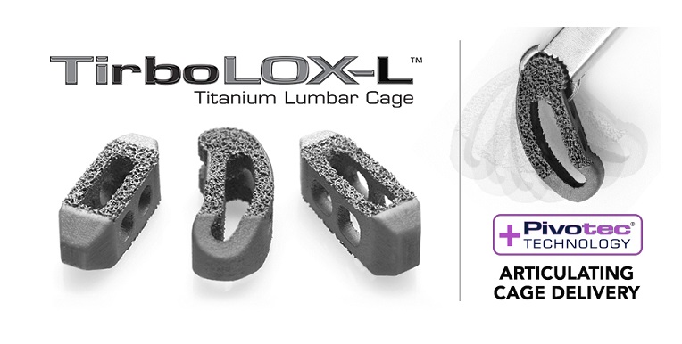 tirbolox-l-tlif-plif-cage-3d-printed-implant-captiva-spine-pr-12bto.jpg