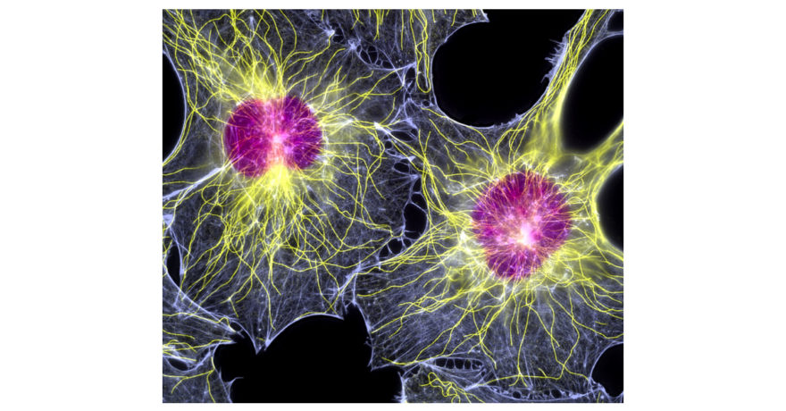 Fibroblast_cells_by_Dr._Torsten_Wittmann.jpg