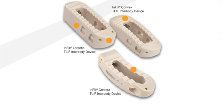 161025-Pinnacle_InFillFusionTechnology_WEB.jpg