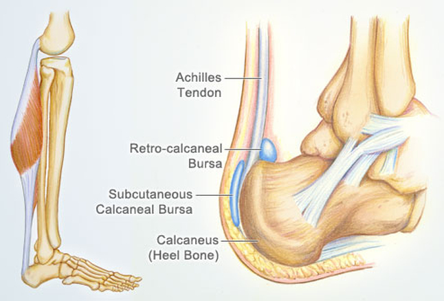 achilles_tendon.jpg