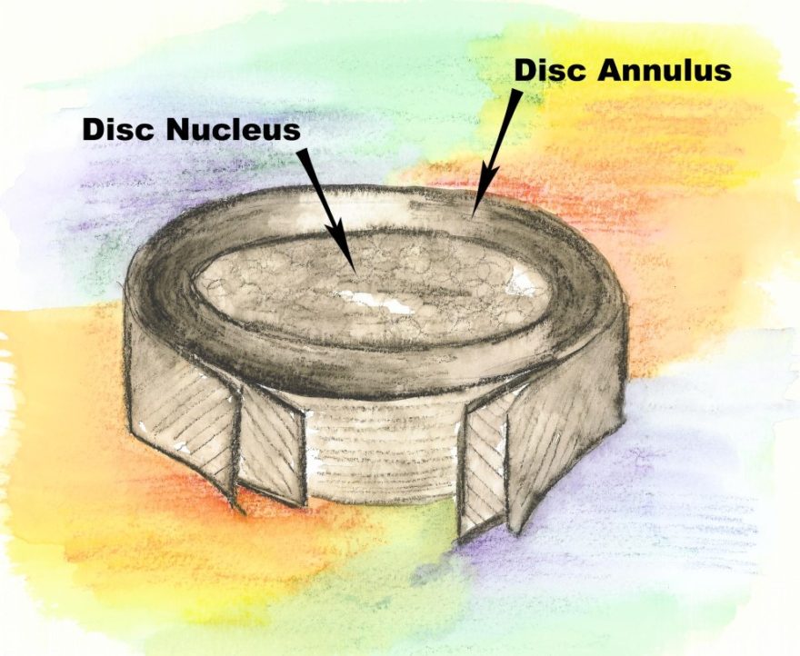 Single-Lumbar-Disc-with-Labels-copy-1.jpg