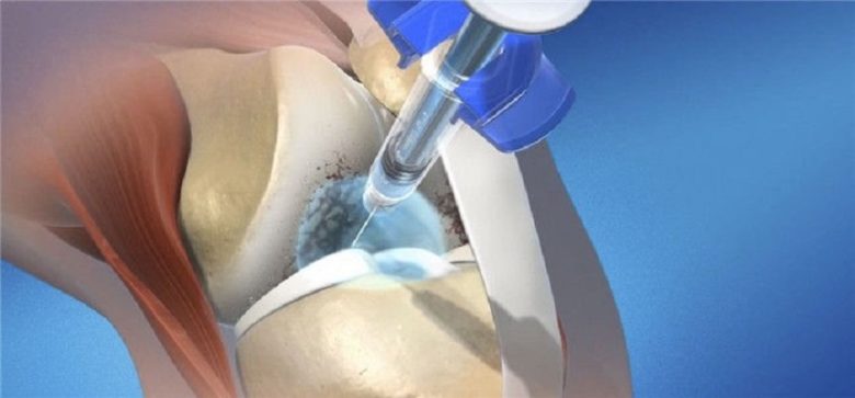 Zimmer Biomet Announces FDA Approval of Expanded 26week Zimmer Biomet Announces FDA Approval of Expanded 26week