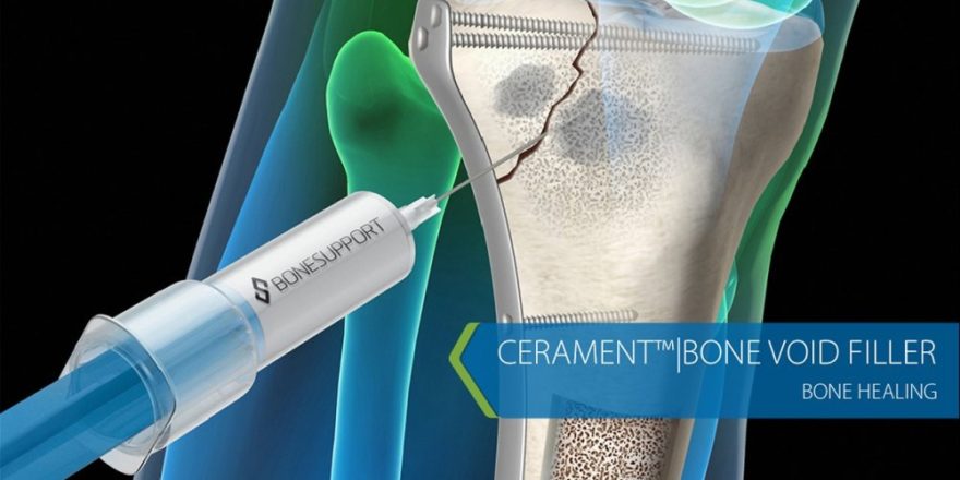 cerament-bone-healing-17897b-h900-1.jpg