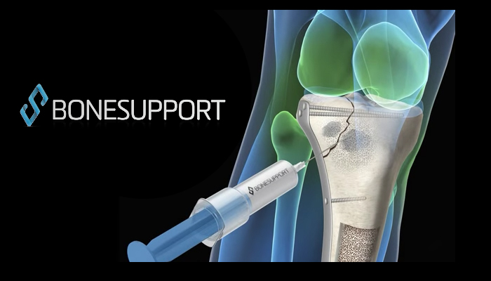 bonesupport-cerament-g-7x4.jpg