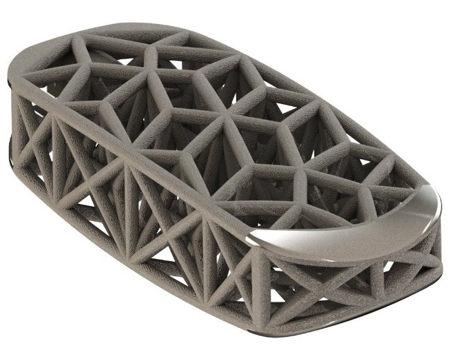 4web-medical-3d-printed-lateral-spine-truss-system.jpg