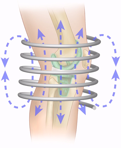 magnetic-fields-around-knee.jpg