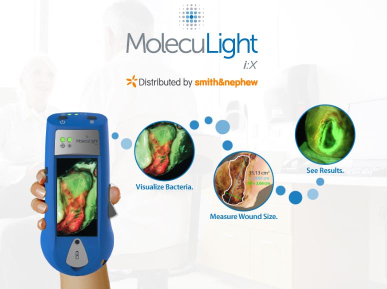 MolecuLight.jpg