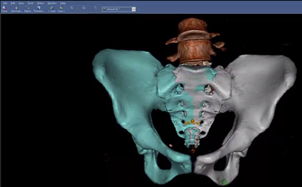 3dpelvictrauma-1024x576.png