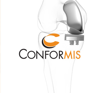 conformis-1.jpg