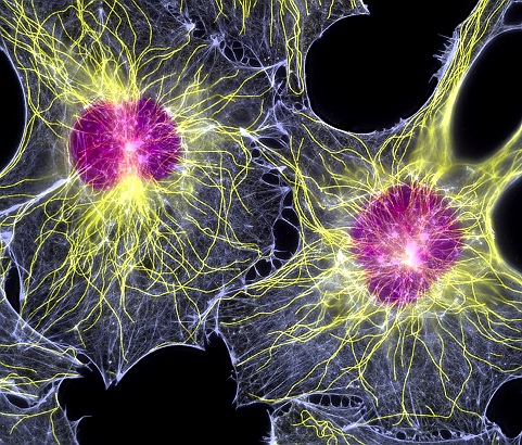 Fibroblast_cells_by_Dr._Torsten_Wittmann-1.jpg