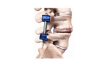 SCOUTIDE_Spineology_Image-pbi2a-1.jpg