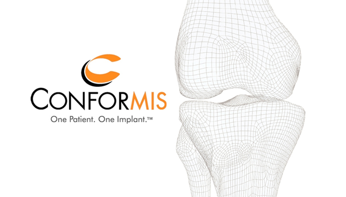 conformis-7x4-1.jpg